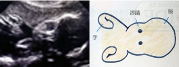 怀孕27周 胎儿的脑容量已经明显增大啰!