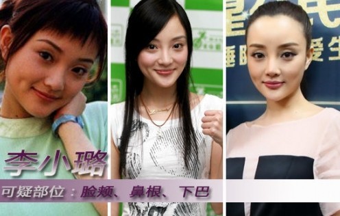 郑爽杨幂李小璐整容真相(组图)