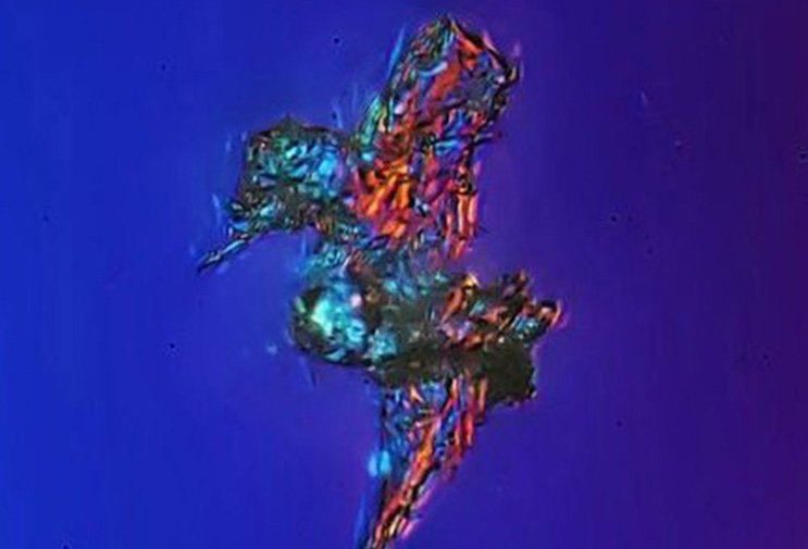 浙江年轻女主播心梗猝死 高职压下重视自检